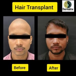 hair_treatment_mumbai
